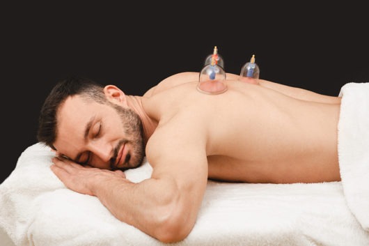 Cupping Therapy