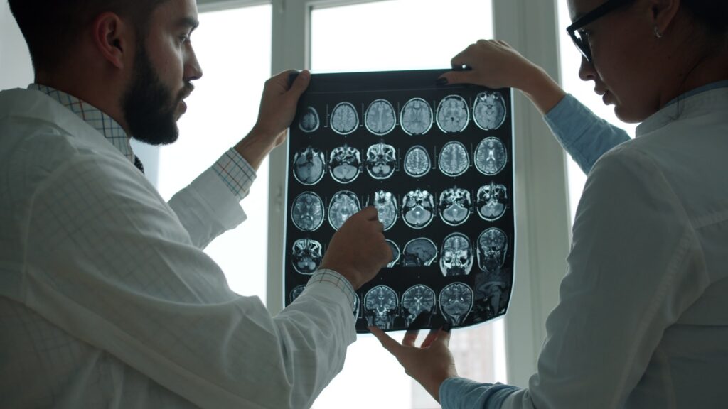 Two doctors examining a brain MRI scan on a lightbox