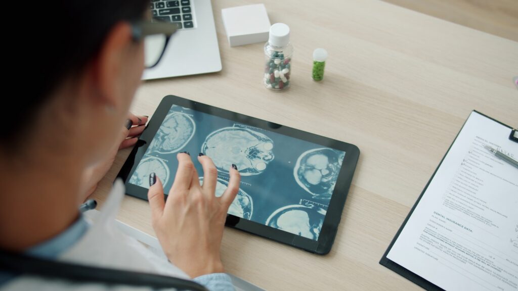 Doctor reviewing brain MRI scans on a tablet during a neurological assessment